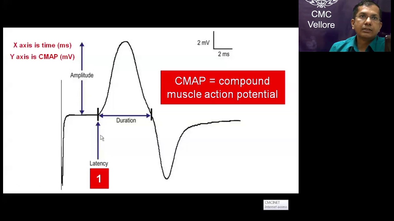 Neuroelectrophysiology: nerve conduction studies -Dr Vivek Mathew