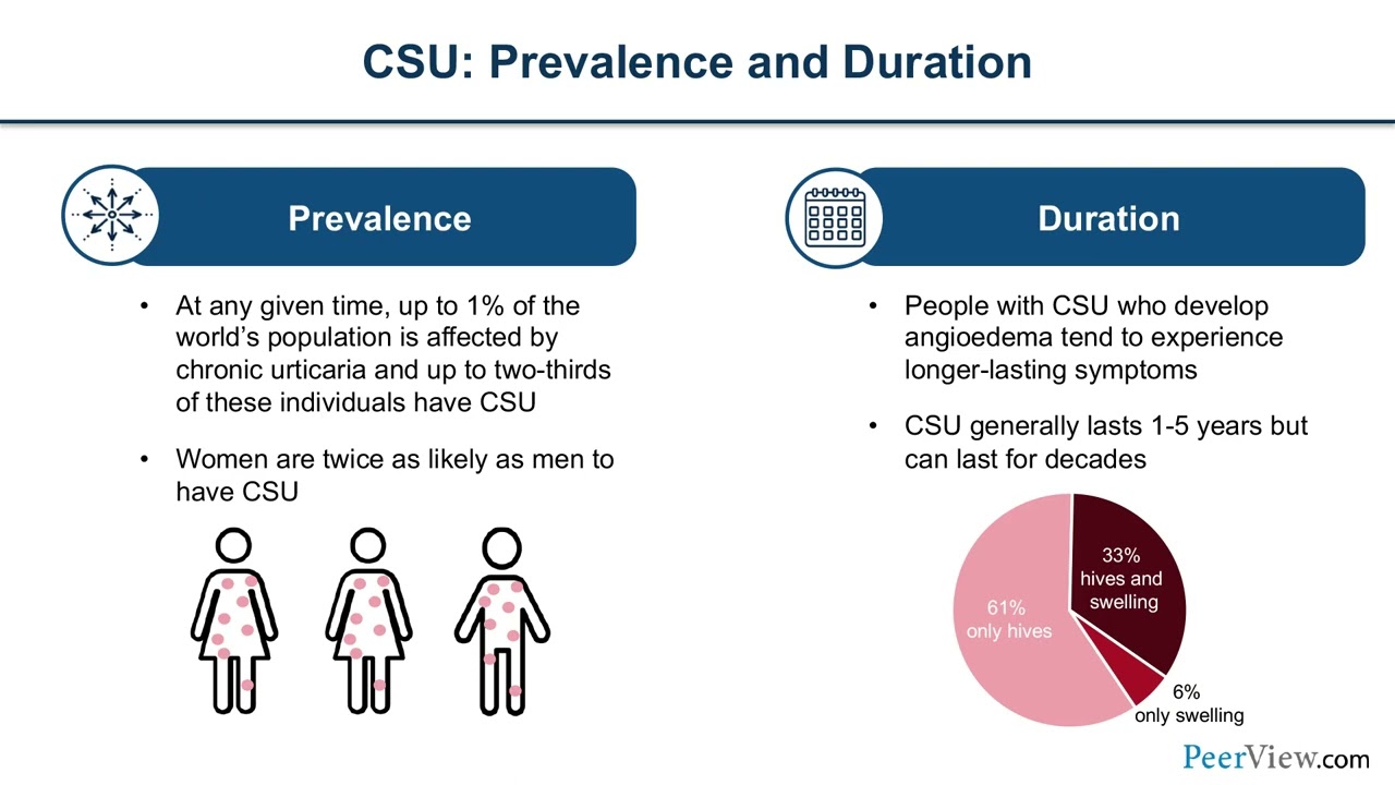 Advances in Chronic Spontaneous Urticaria