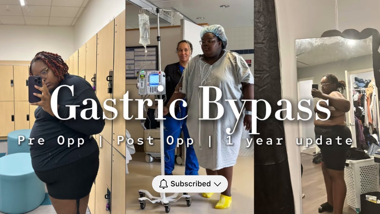 From Pre-Surgery to Now | Gastric Bypass 1 Yr Anniversary