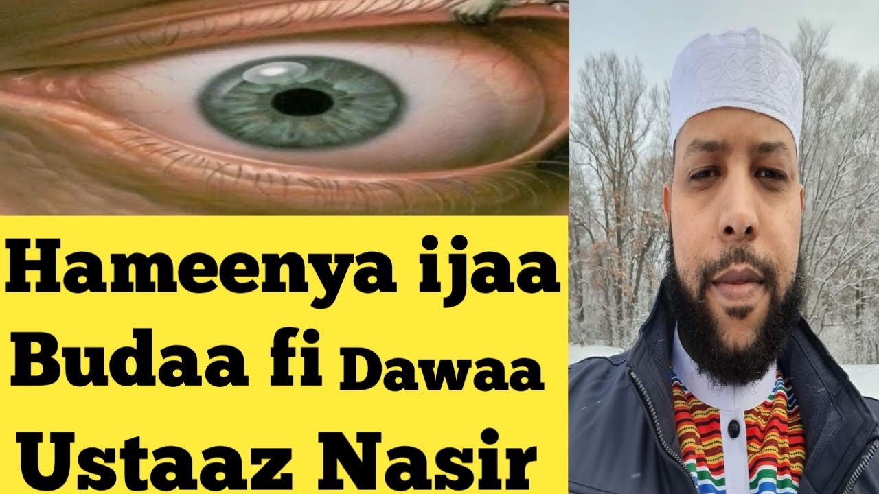 Hammeenya ija namaa ykn budaan namarran gahuu fi Dawaa isaa ustaaz Nasir hamza