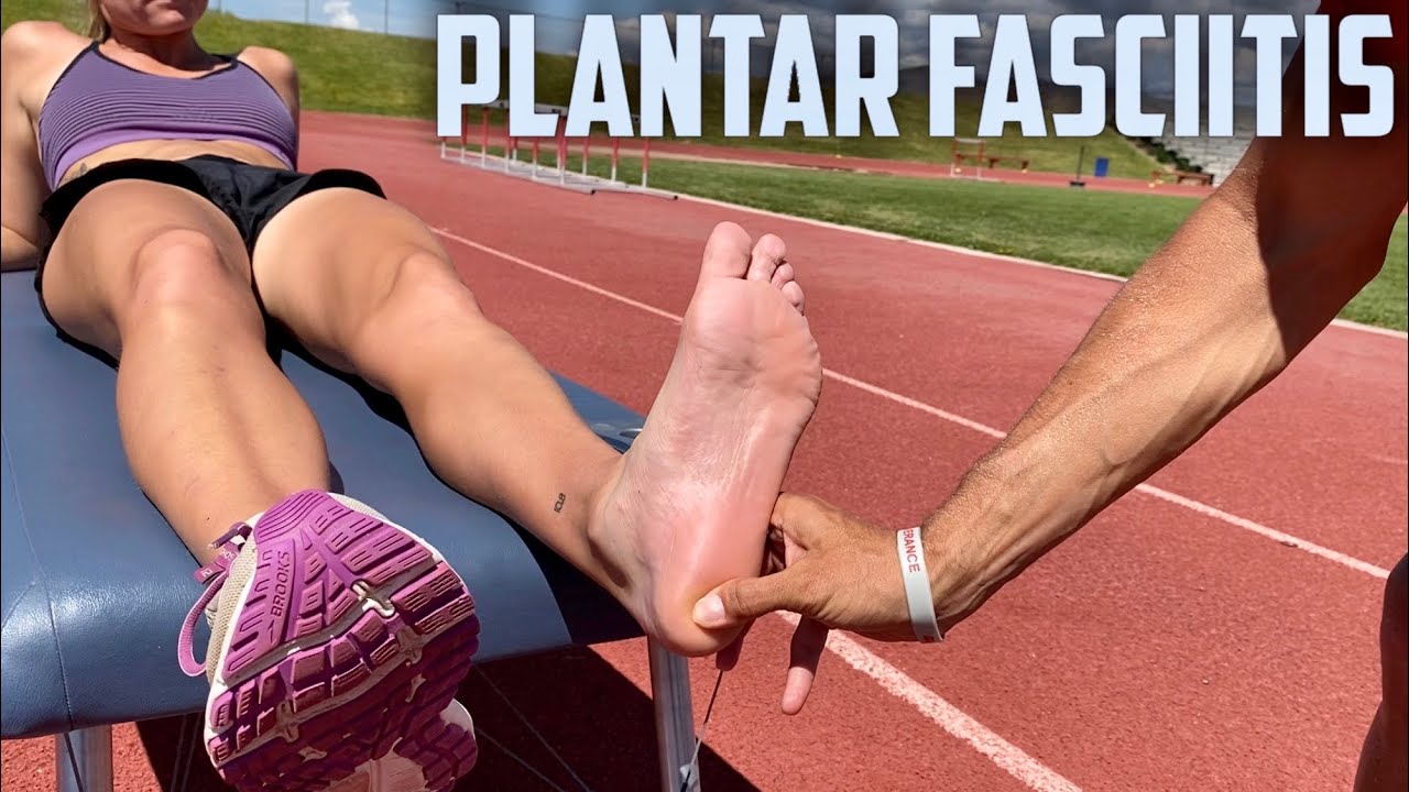 How to FIX Plantar Fasciitis [Chiropractic Treatment]