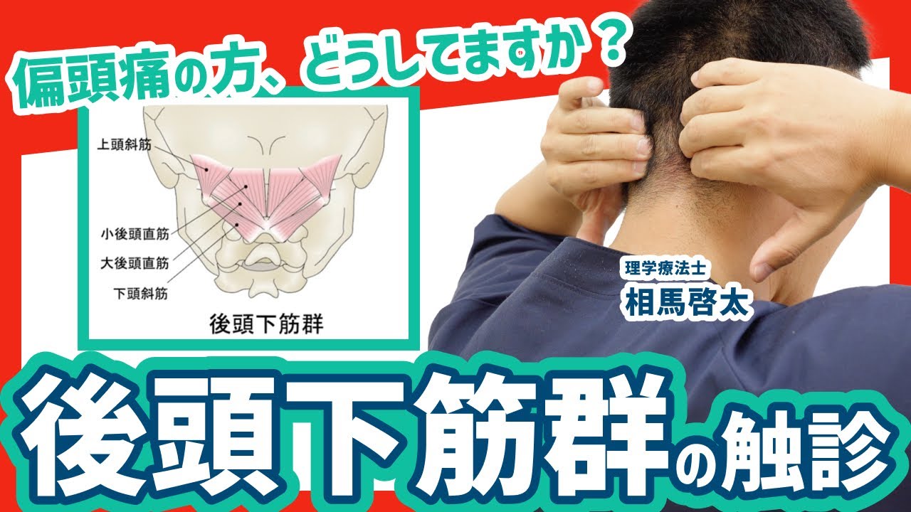 【偏頭痛どうしてますか？】後頭下筋群の触診と頭痛の関係