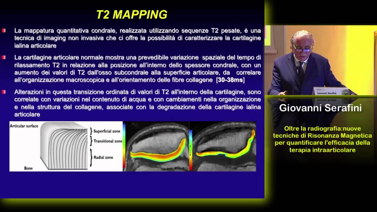 Nuove tecniche di Risonanza Magnetica per valutare la terapia intraarticolare