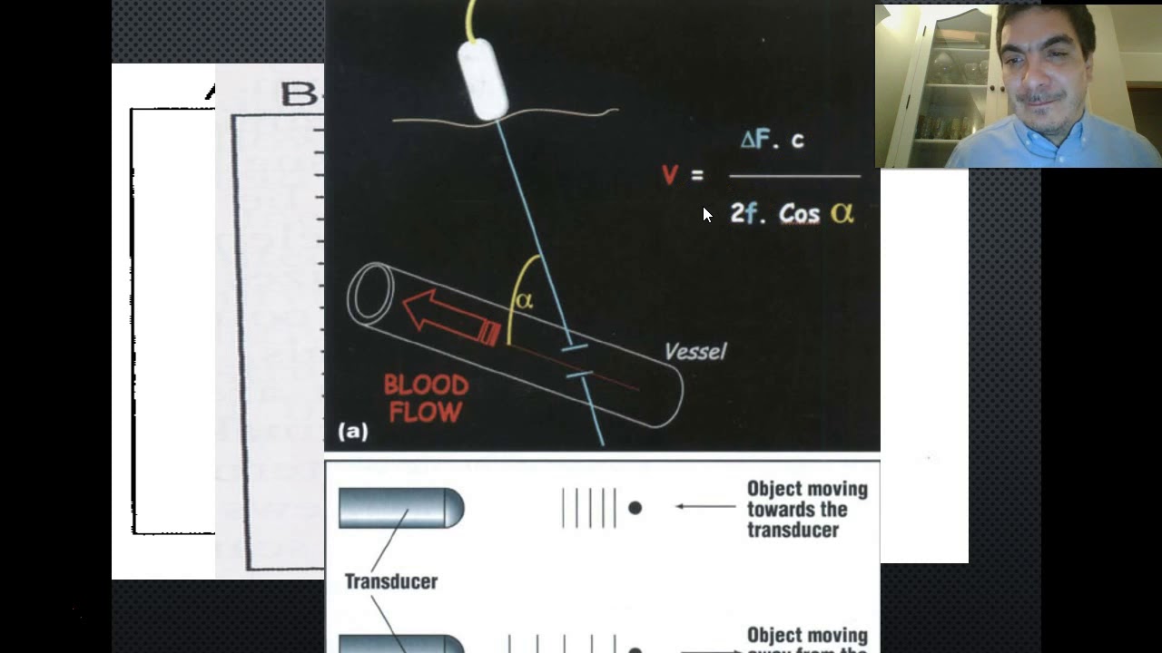 Ecografía abdominal parte 1