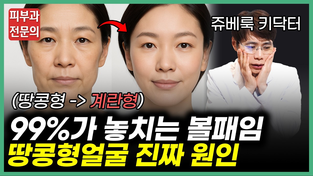 볼패임? 볼꺼짐? 땅콩형 얼굴 '이것'만 알면 해결할 수 있습니다!