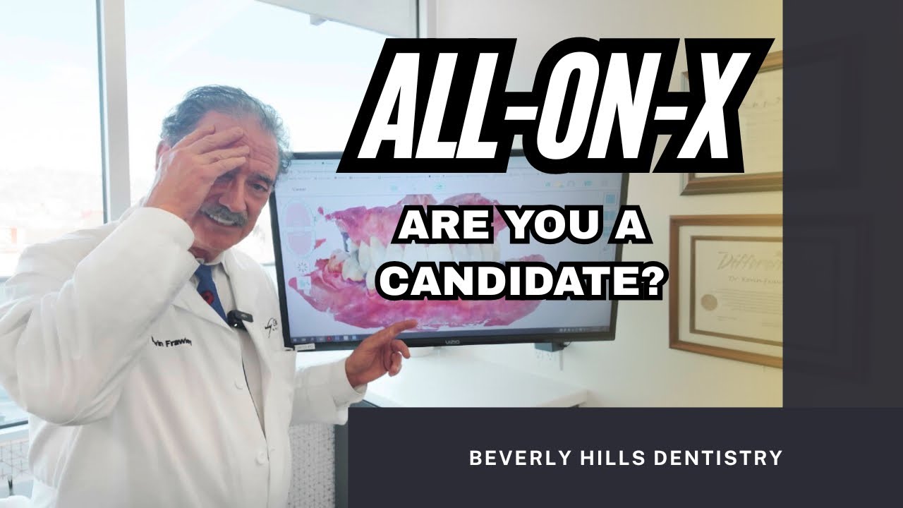 All-on-X Dental Implants: Are You REALLY a Candidate? | Second Opinion Explained