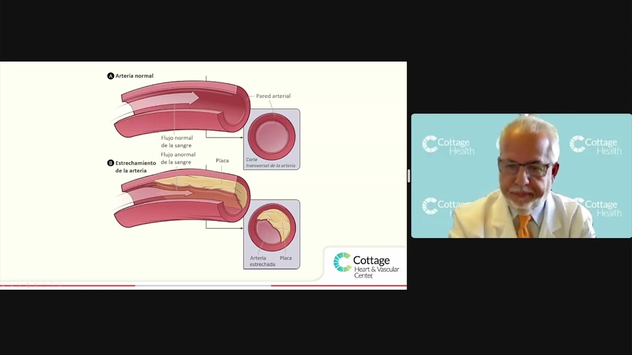 Meet the Doctor – Heart Disease Prevention – Dr. Garcia-Revilla – Spanish