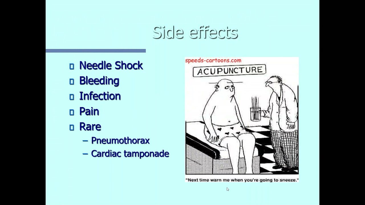 Evidence-based Use of Acupuncture