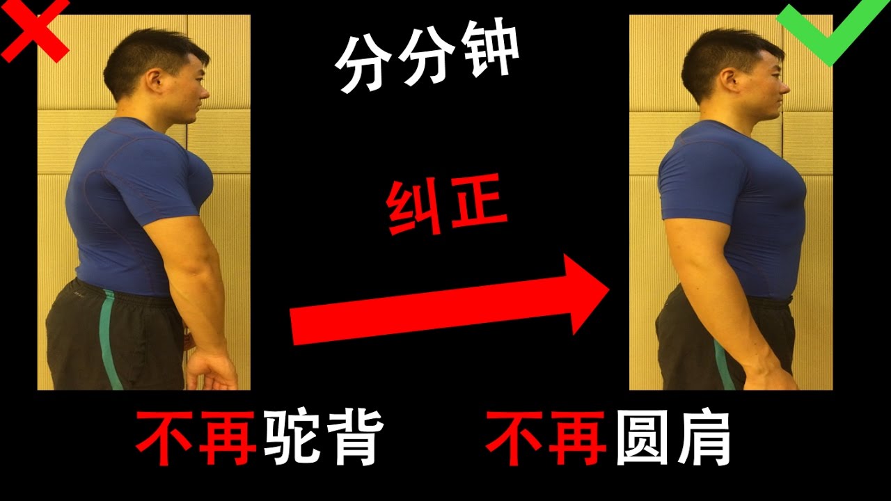 如何： 纠正驼背？
