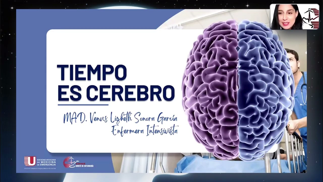 Tiempo es cerebro** 🧠