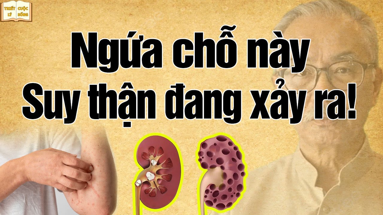 Cơ thể ngứa 5 chỗ n&agrave;y, Suy Thận Đang Xảy Ra - đừng coi thường dấu hiệu nhỏ