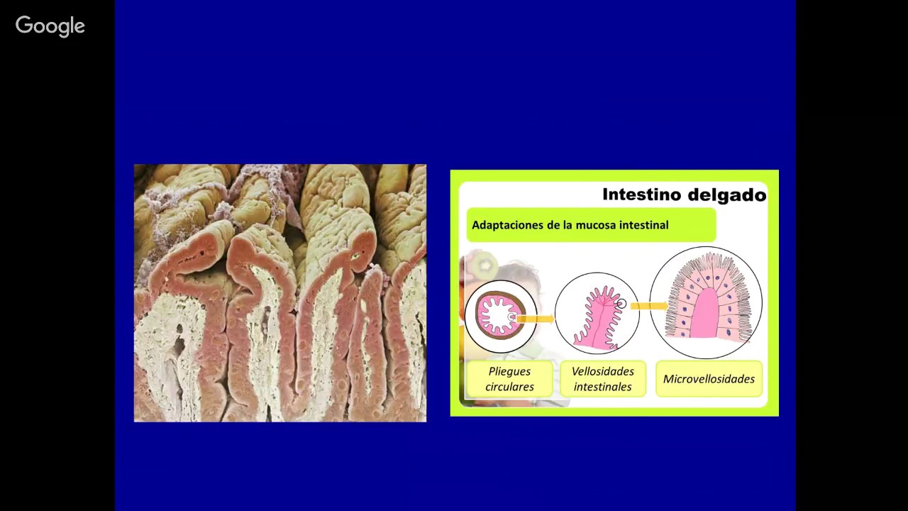 Galactosemia: Fisiopatología, diagnóstico y tratamiento
