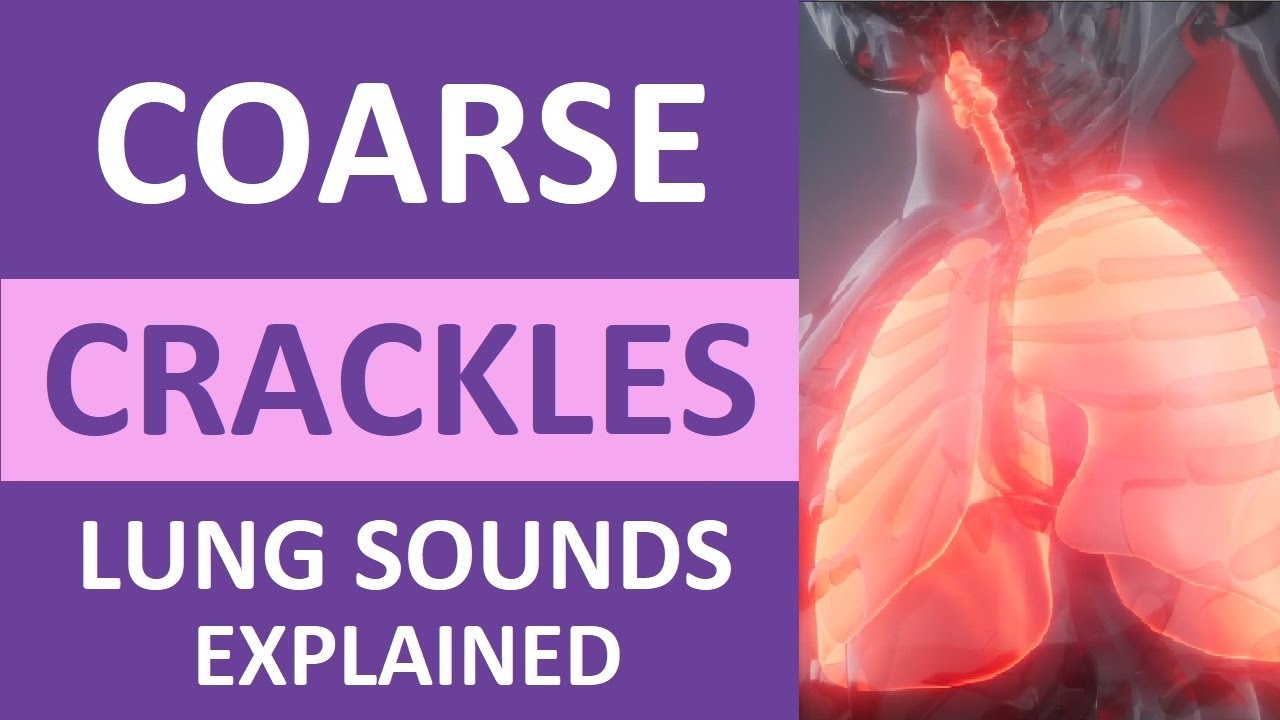 Coarse Crackles Lung Sounds Audio, Causes, Auscultation, Nursing NCLEX Review