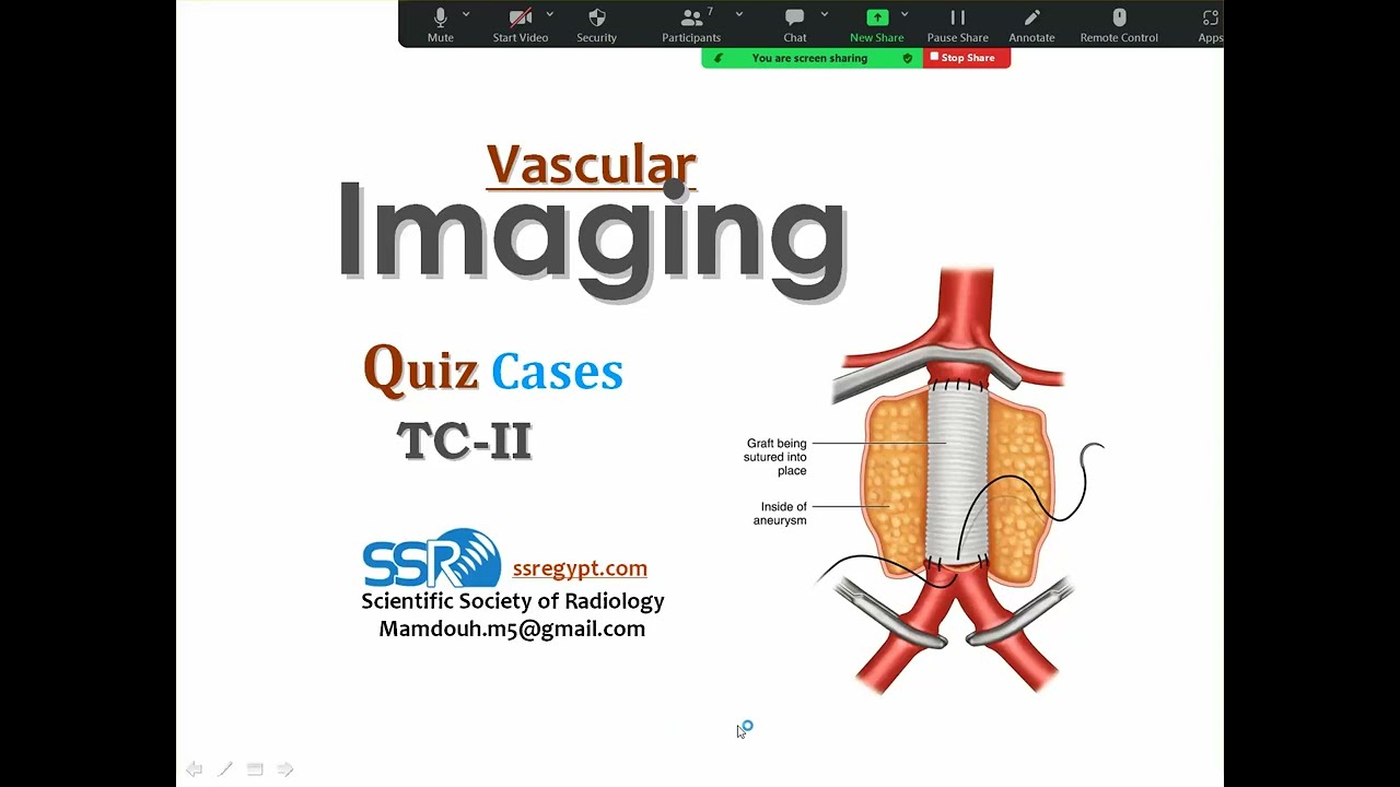 Revision Vascular Imaging Quiz cases G2