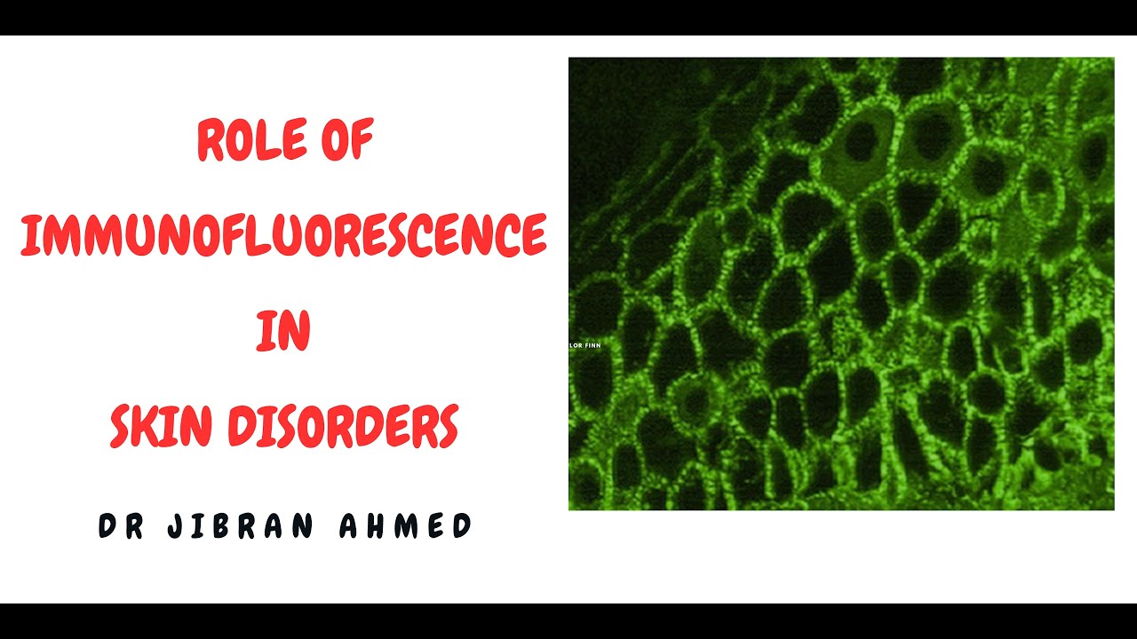 ROLE OF IMMUNOFLUORESCENCE IN DIAGNOSIS OF SKIN DISEASES II SIMPLY PATHOLOGY II POST GRADUATE