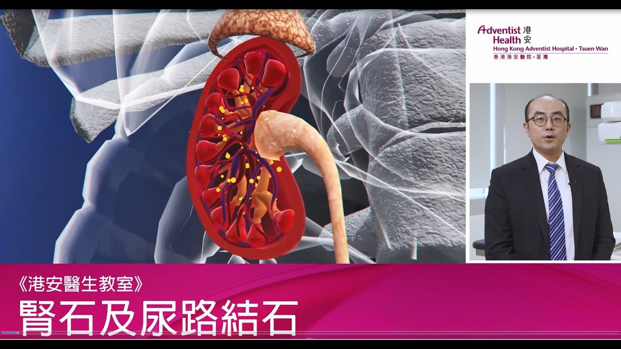 【港安醫生教室—別讓壞習慣養出腎結石！認識預防及治療方法】