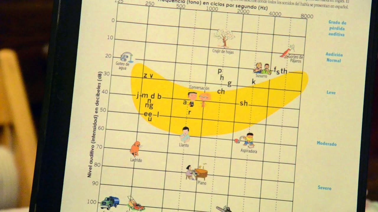 ¿Cómo entender una audiometría?