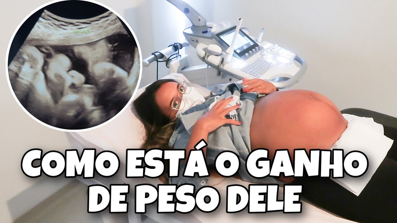 ÚLTIMO ULTRASSOM ANTES DO PARTO - COMO ESTÁ O PESO E TAMANHO DO MICAEL | Denise Porto