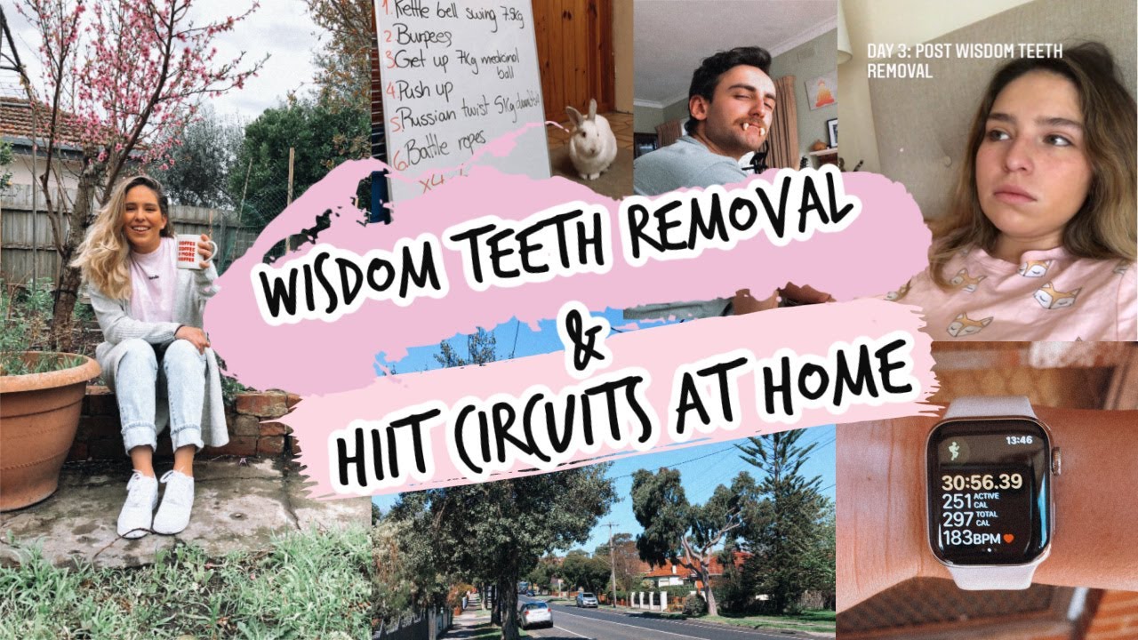 WISDOM TEETH REMOVAL VLOG + HIIT CIRCUITS AT HOME!!