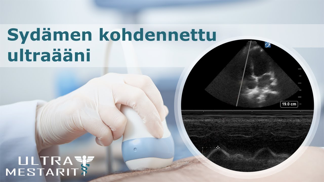 Sydämen kohdennettu ultraääni