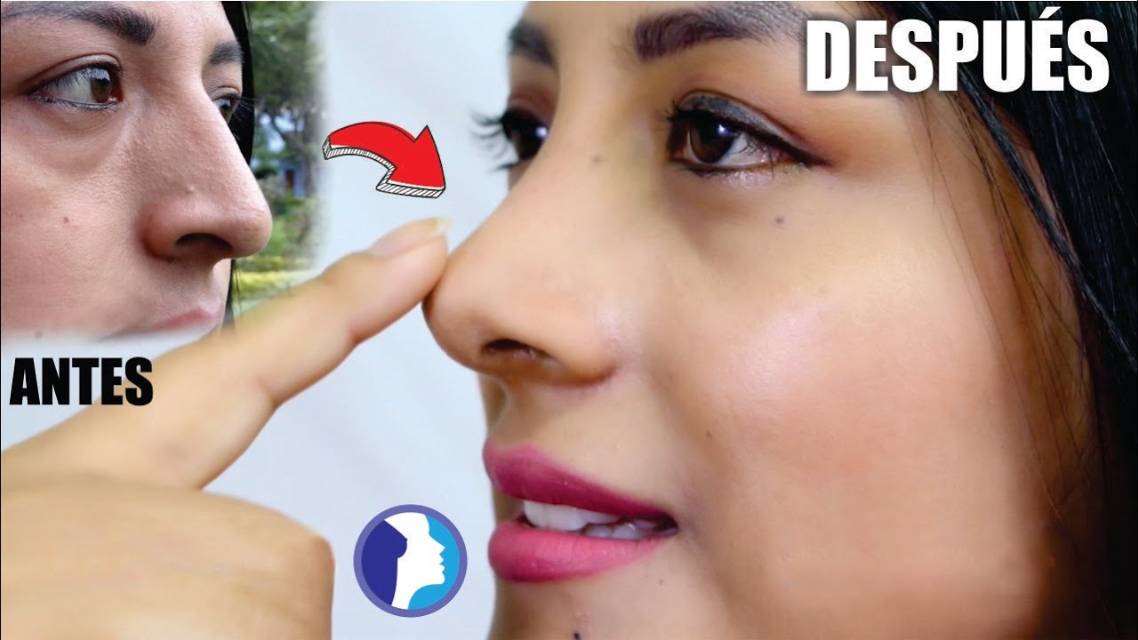 !Que tal CAMBIO!...quedó Hermosa 💋 RINOPLASTÍA 👃🏼 Rino estética 👍🏼 DR PERCY NEVADO Cirugía Plástica