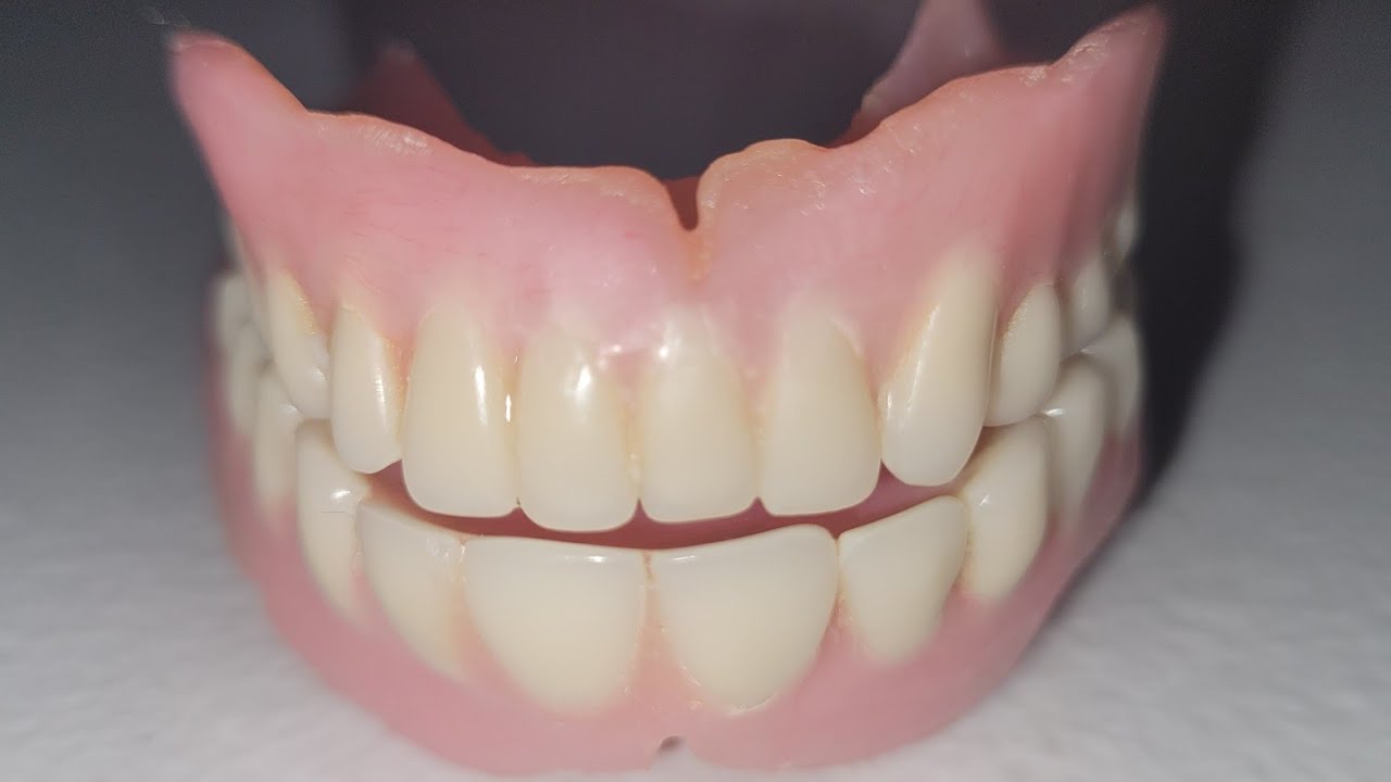How to remove denture adhesive from your gums. 