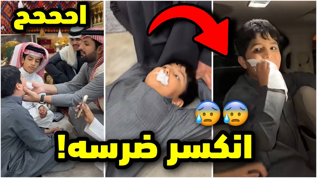 فراج كسر ضرس قزيع بيده!!😰اح #فراج_قزيع_السهلي 