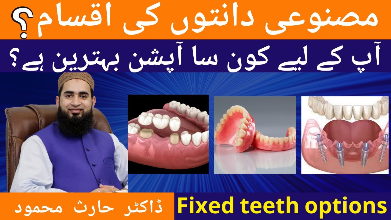 The Best Fixed Teeth Options for Missing Teeth | Dental Bridges, Dental Implants, Dentures in Urdu