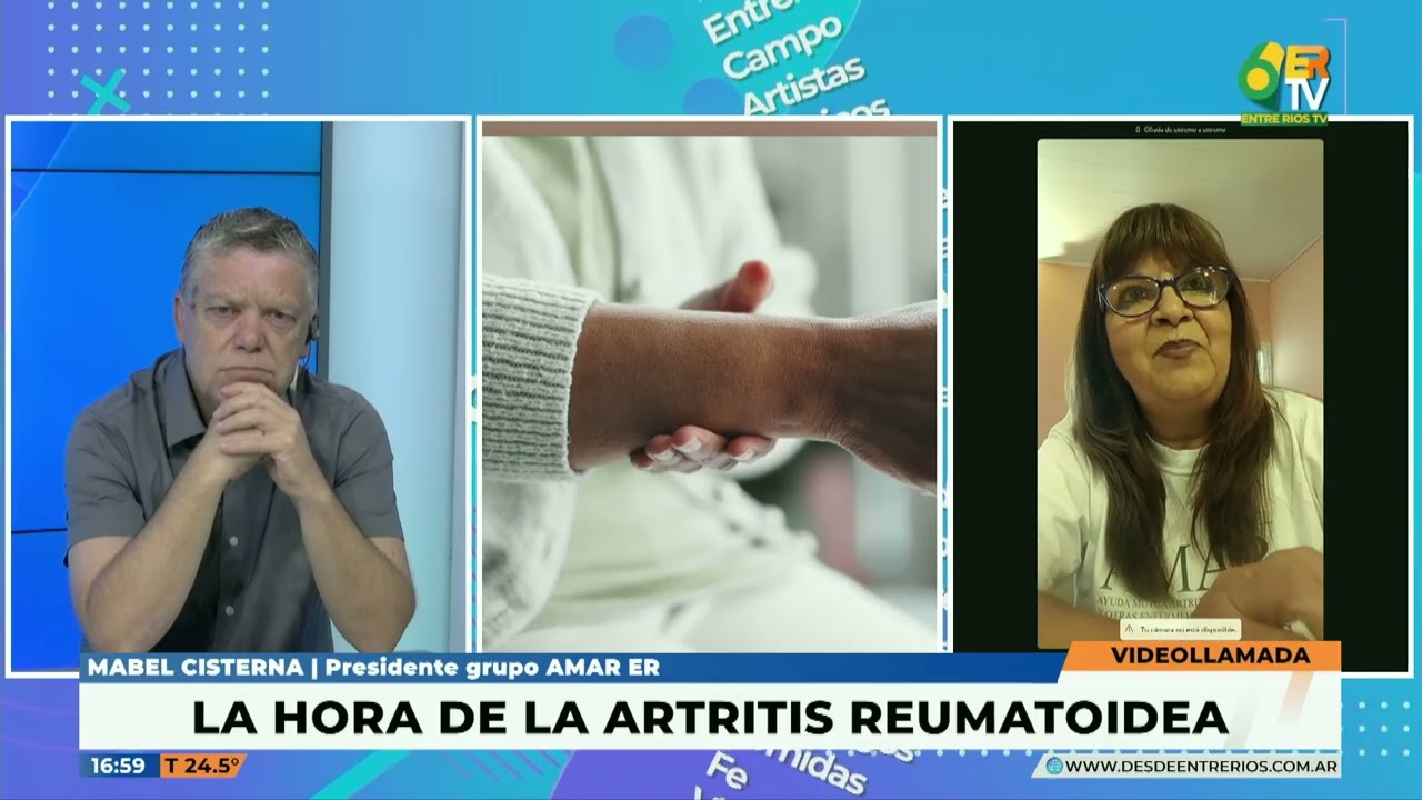 LA HORA DE....  LA ARTRITIS REUMATOIDEA