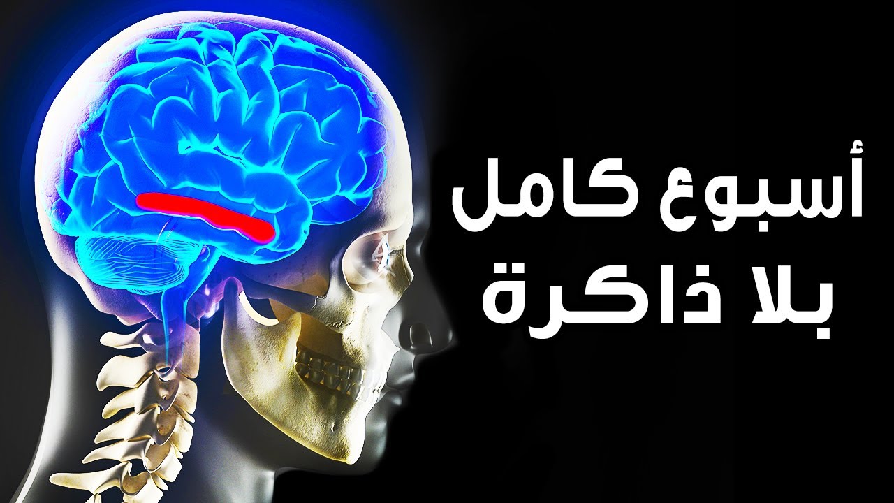 ماذا لو فقد كل سكان العالم ذاكرتهم في نفس الوقت؟