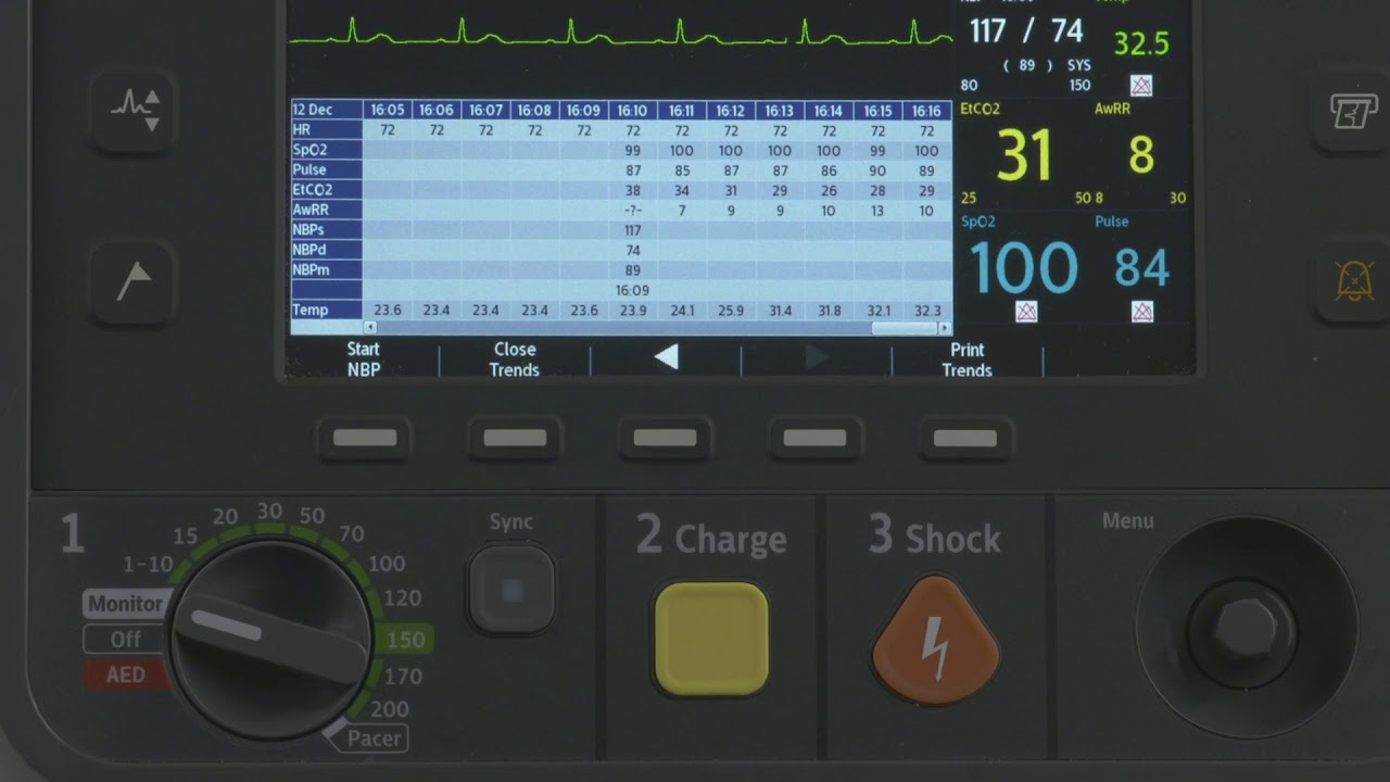 Vital Signs Trending with the HeartStart Intrepid monitor/defibrillator