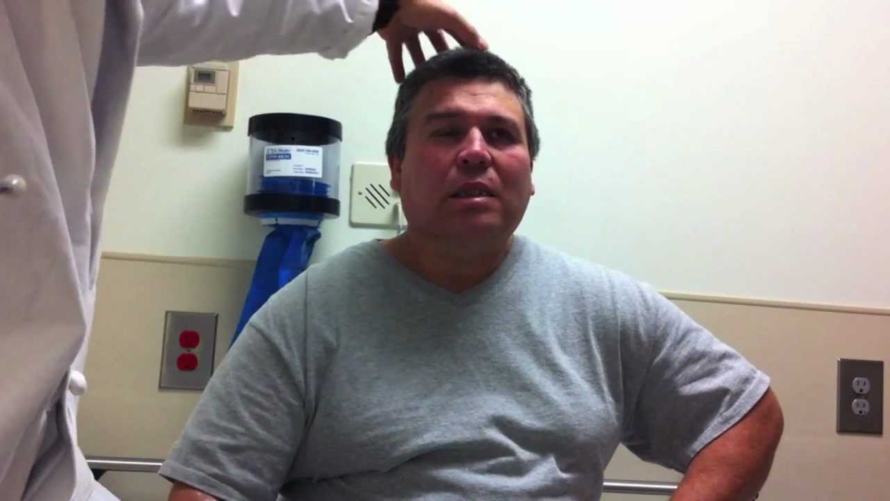 Clinical Case - Bells Palsy