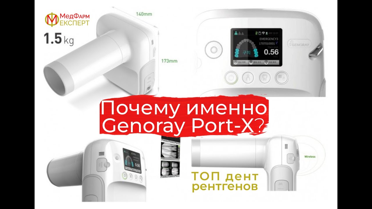 Рентген Genoray PORT-X. Обзор портативного рентгена для стоматологии. ТОП дентальных рентгенов.