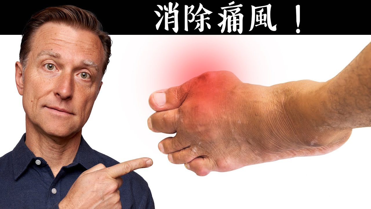 第一名痛風的自然療法,柏格醫生 Dr Berg
