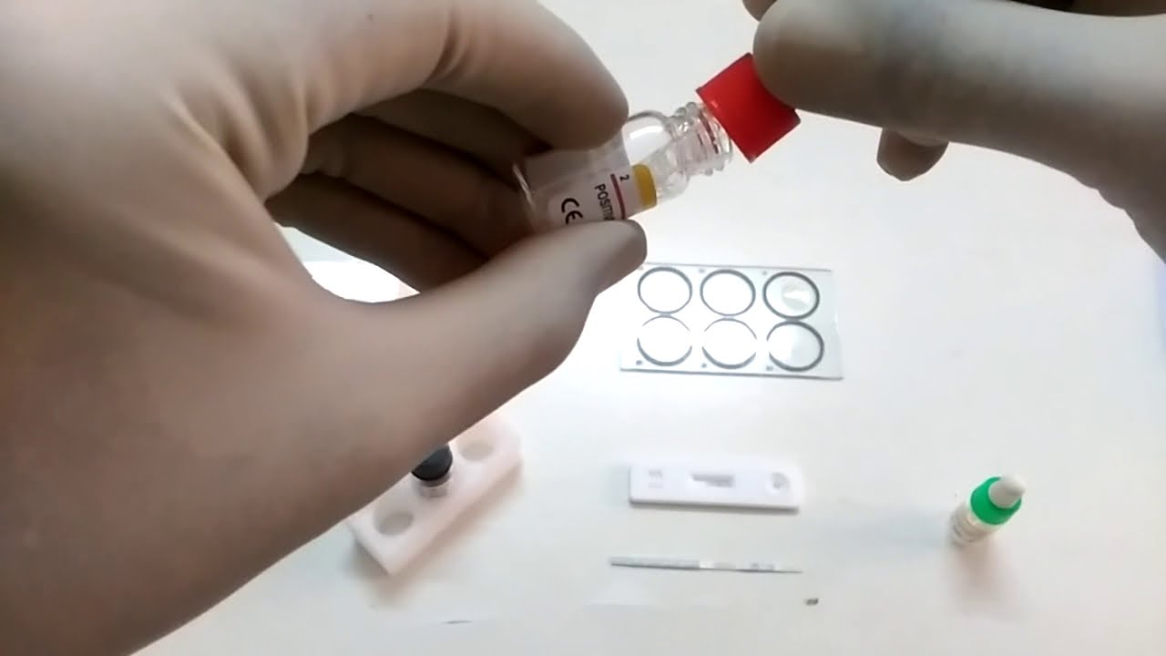 VDRL Test in Hindi | RPR Test for Syphilis । VDRL Test procedure