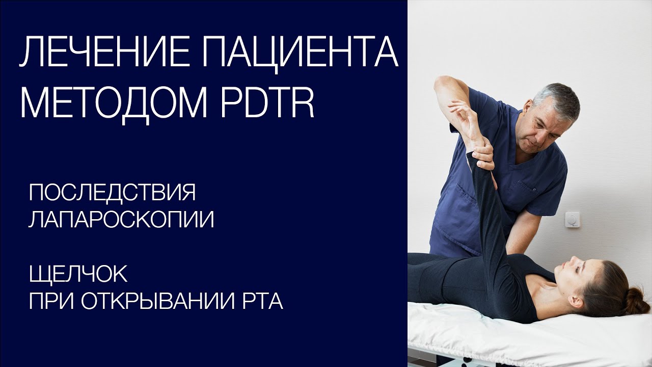 Лапароскопия - последствия.  Щелчок в челюсти.  Лечение реального  пациента методом PDTR