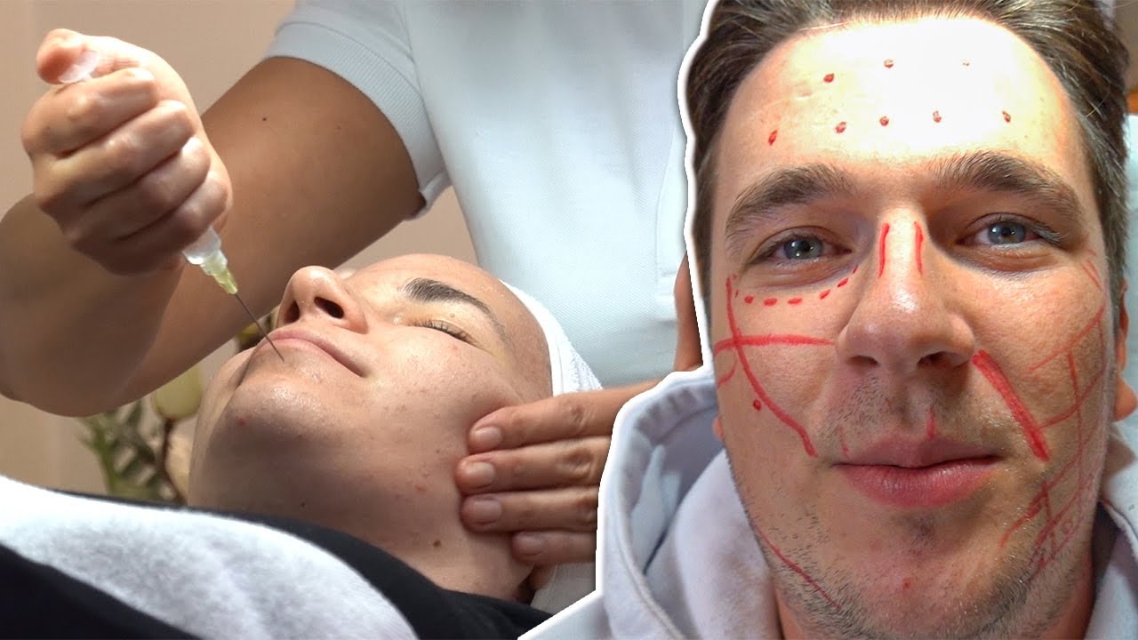 PROBALI SMO ESTETSKU MEDICINU! *promena*