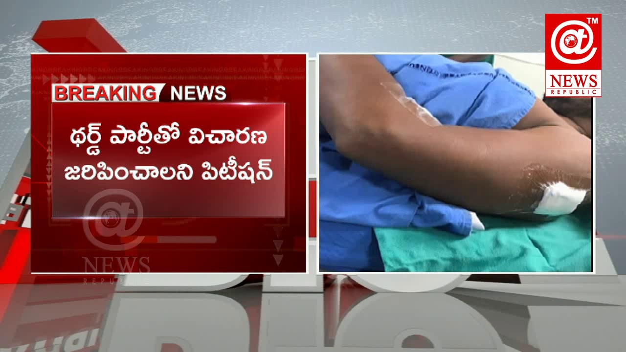 YS Jagan Attack | High Court To Hear YV Subba Reddy Writ Petition Today | AT News Republic