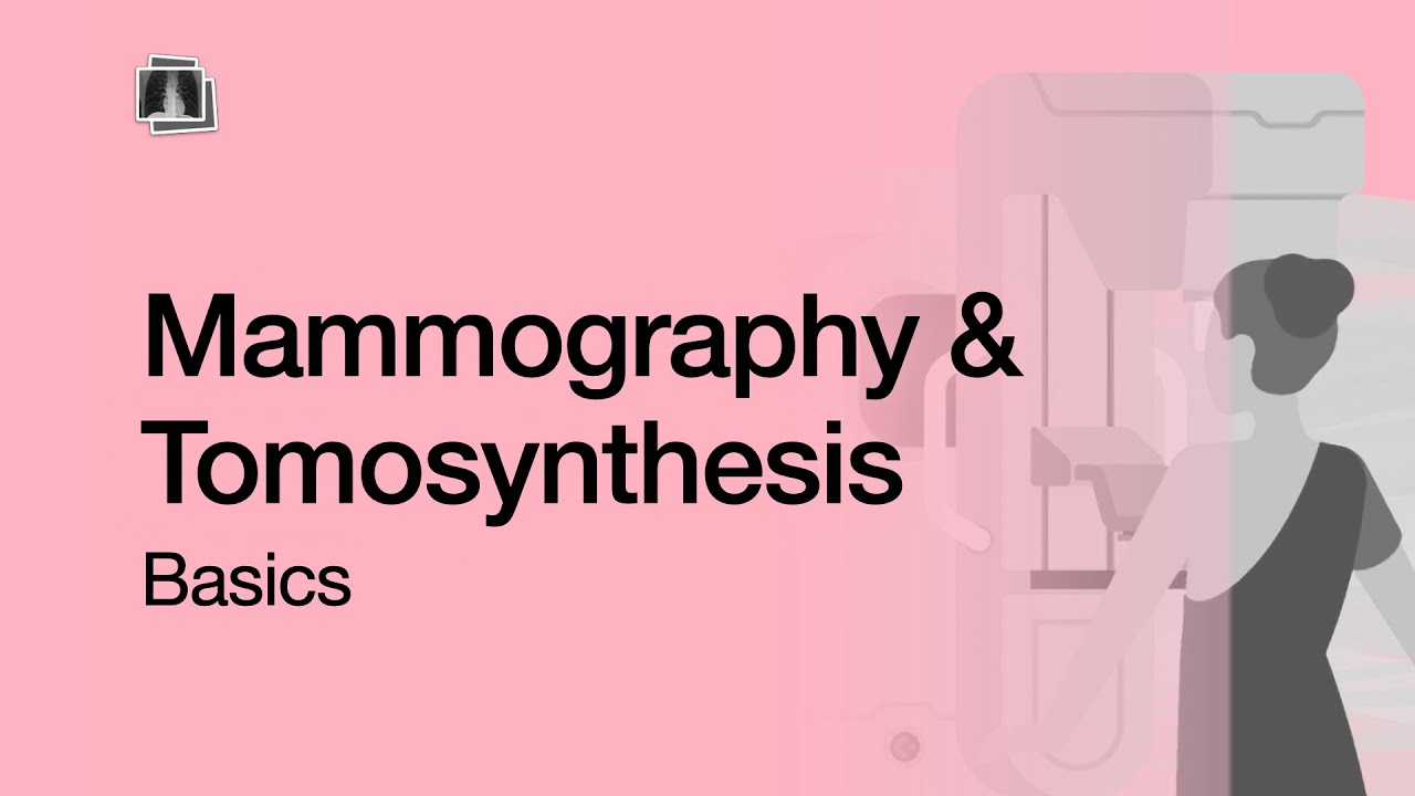 Mammography & Tomosynthesis Basics