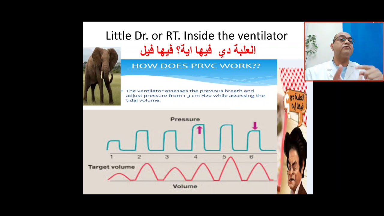 How does PRVC work? pressure regulated volume control, targeted volume control, volume Guarantee VG