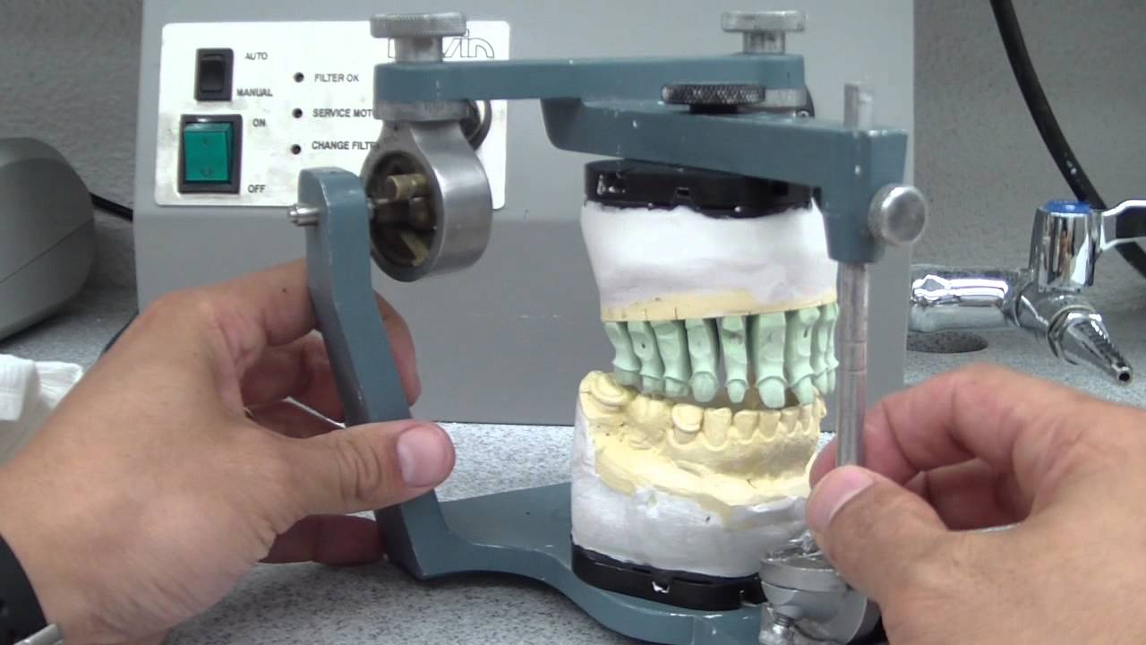 Custom Incisal Guide Table (1/3) What is this thing?