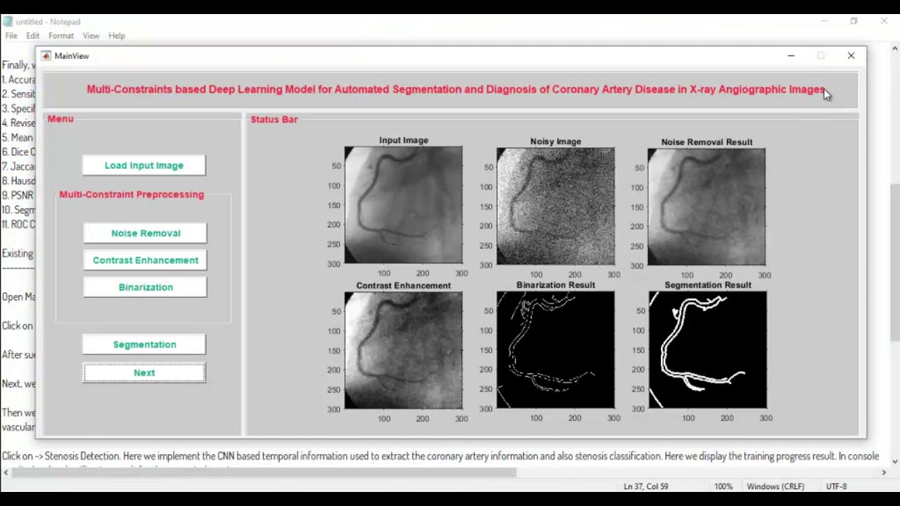 Segmentation of X Ray Coronary Angiographic Images