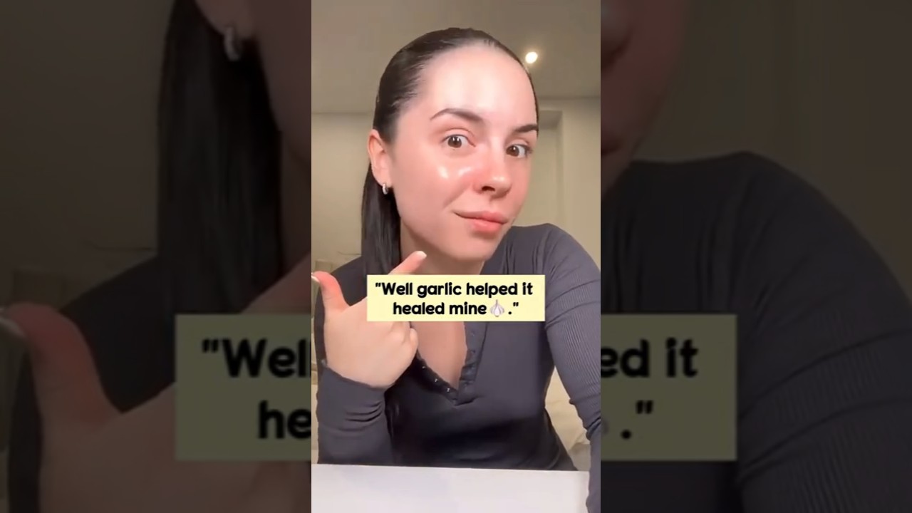 Clear Skin Naturally 🍯🧄 Eat 2 Garlic Honey Cloves Daily for Acne-Free Glow #skincare #shorts #glowup