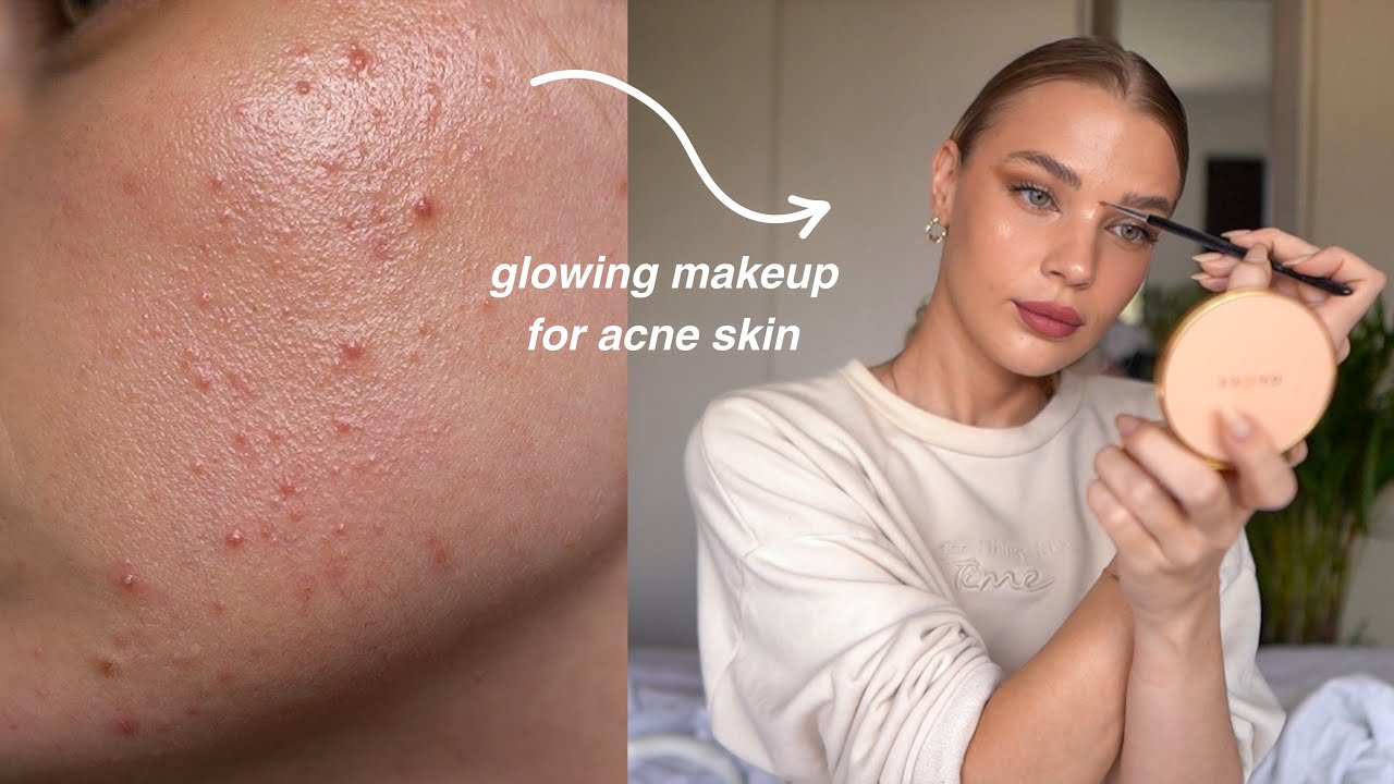 glowing makeup for acne skin