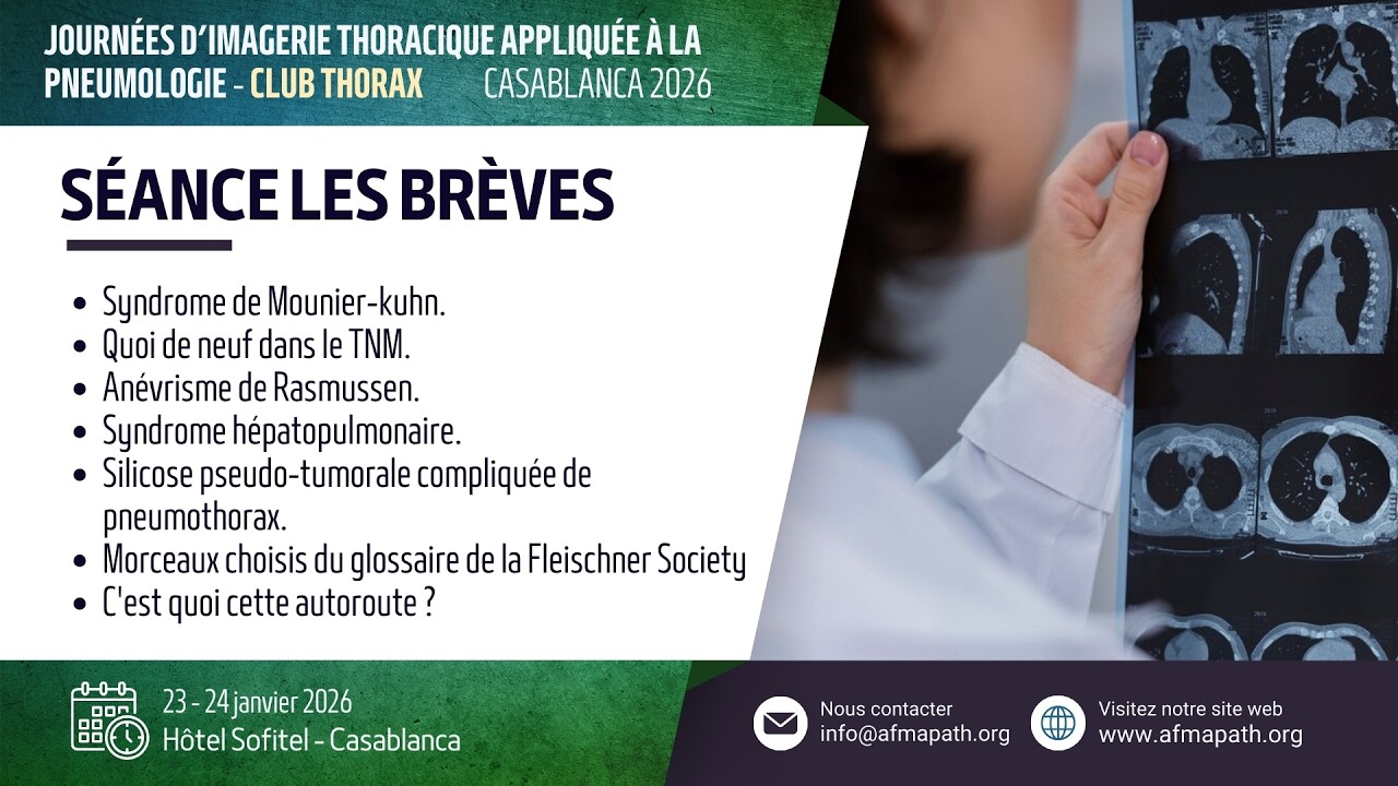 Les Brèves Partie N°1