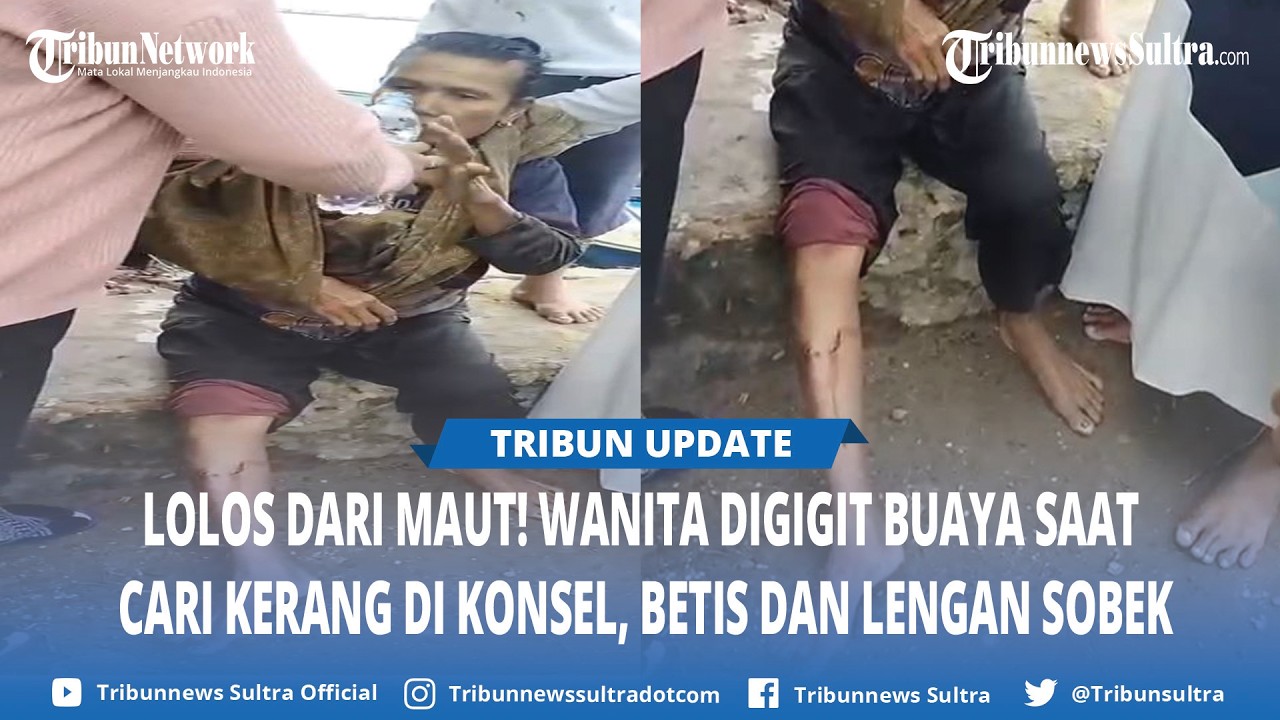Wanita Digigit Buaya saat Cari Kerang di Konawe Selatan Sulawesi Tenggara, Betis dan Lengan Sobek