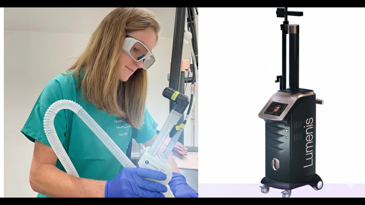 Lumenis UltraPulse – High-Peak-Power CO₂ Laser for Fractional and Surgical Resurfacing