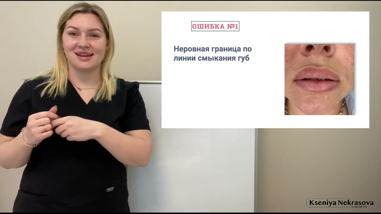 7 частых ошибок контурной пластики губ