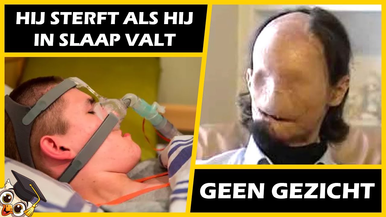 20 Mensen Waarvan Je Niet Gelooft Dat Ze Bestaan