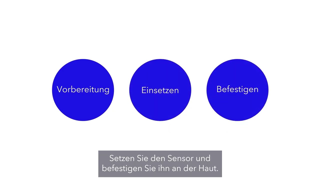 Simplera Sync&trade; Sensor &ndash; Setzen und Verbinden des Sensors